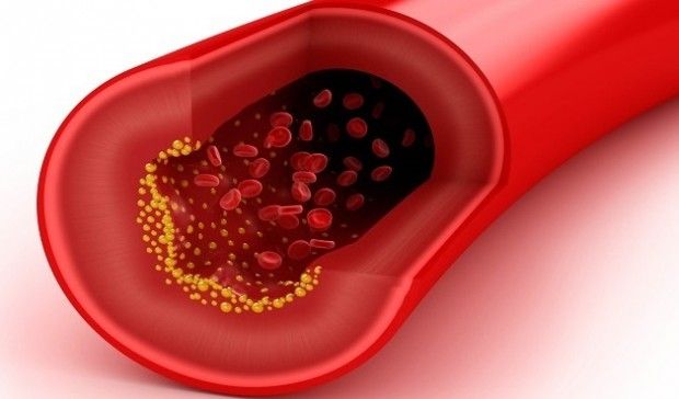 Como bajar el colesterol de forma natural