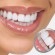Los 4 mejores blanqueadores dentales que funcionan
