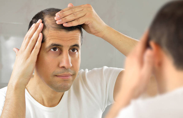 4 Mejores Productos para la Caída del Cabello (Hombres)