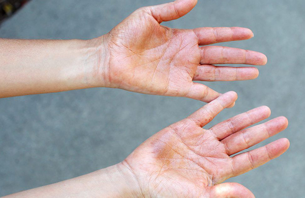 mejor autobronceador para piel blanca mejor autobronceador para piel blanca